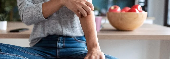 Person kratzt sich am Arm